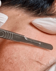 Få 10 % rabatt på din första behandling hos LaDerma